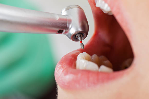 Best Emergency Care for Gum Disease in Corning, NY